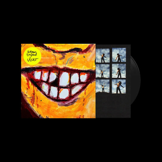 Trelford, Sean - Ulcer